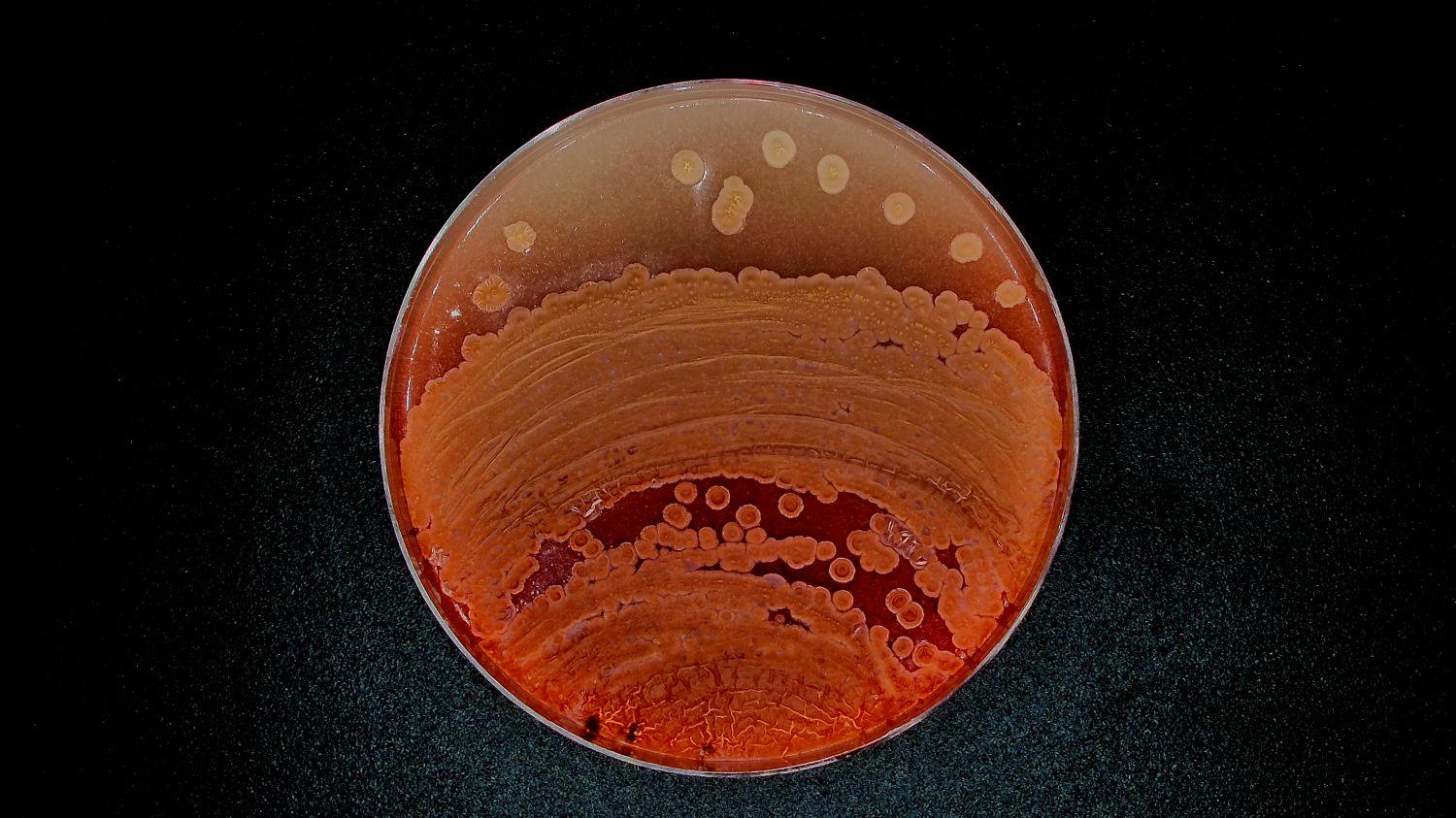 INTER-MICRO